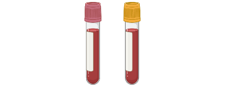 Red and Gold Tubes